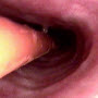 Endoscope